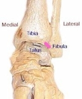 Myfootshop.com Foot and Ankle Knowledge Base - Information about ankle pain Myfootshop.com