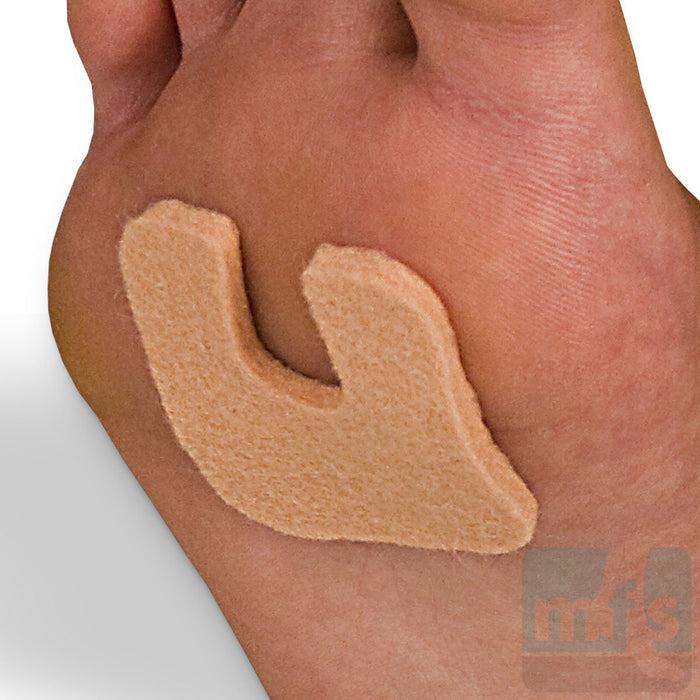 FELTastic® Callus Protectors