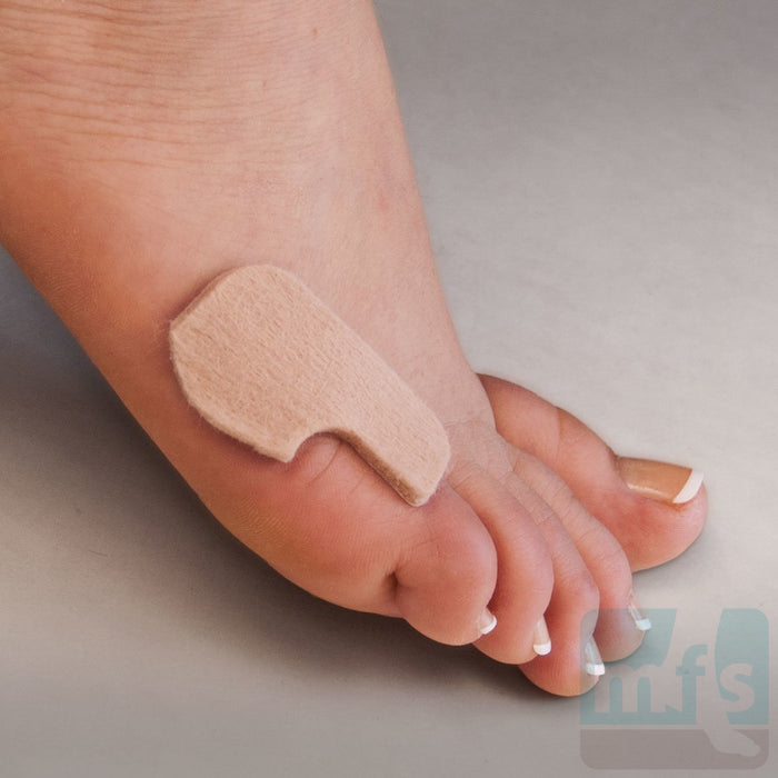 FELTastic® Callus Protectors