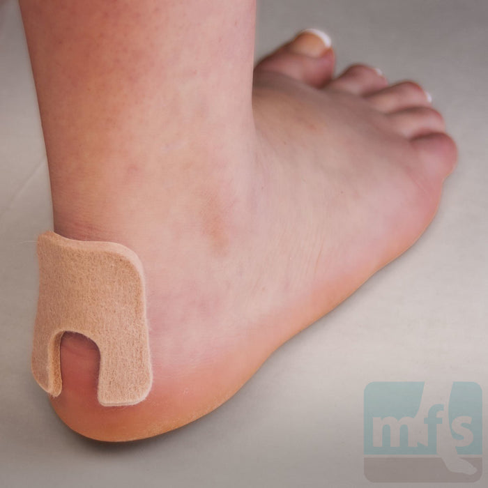 FELTastic® Callus Protectors