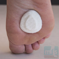 Neuroma Pads - Mini Felt