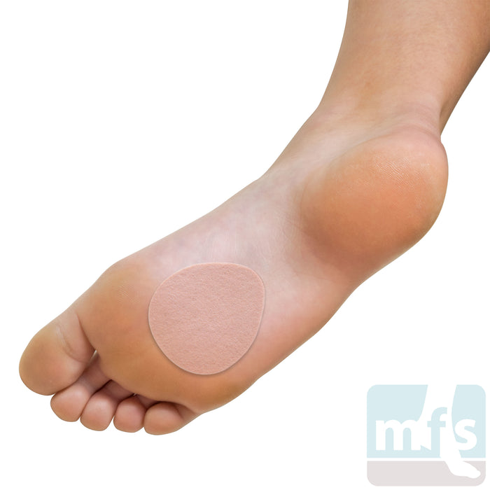 FELTastic® Flat Metatarsal Pads - 1/4" Thick