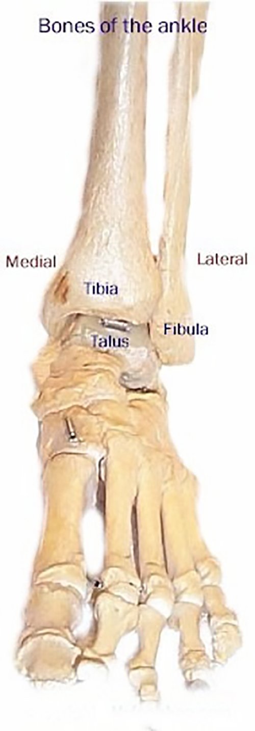 Information about ankle pain - Myfootshop.com Foot and Ankle Knowledge ...