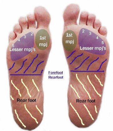 Forefoot Pain | Causes and treatment options | MyFootShop.com