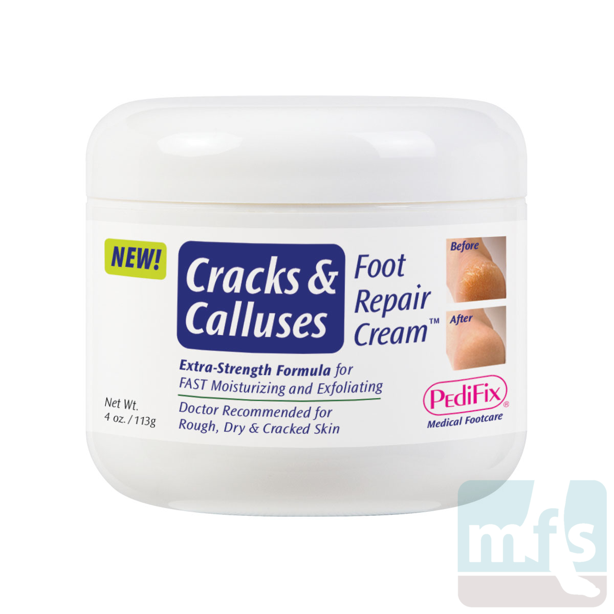 https://www.myfootshop.com/images/thumbs/w_1_0003926_cracks-calluses-foot-repair-cream.jpeg