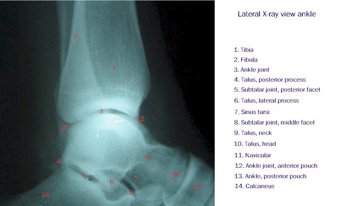 Foot and Heel | Radiology Key